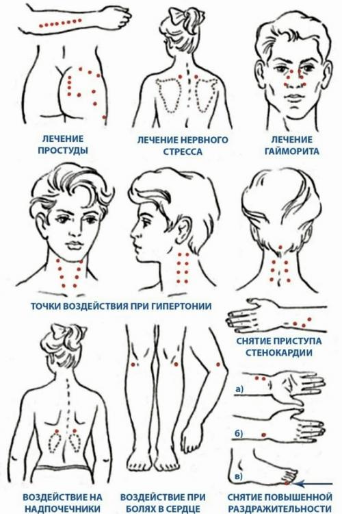 Акупунктура - это один из методов нетрадиционной медицины, который заключается в воздействиях на активные биологические точки на теле человека.  