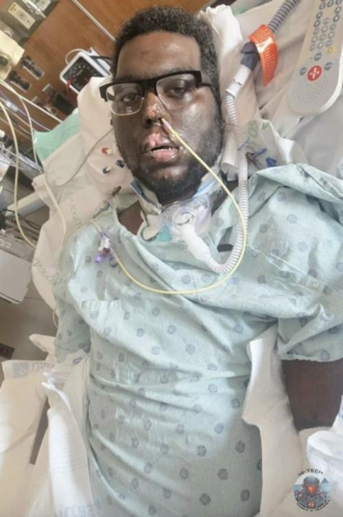 Плюс фобия в копилку: мужчине ампутировали руки и ноги после визита к стоматологу. 

