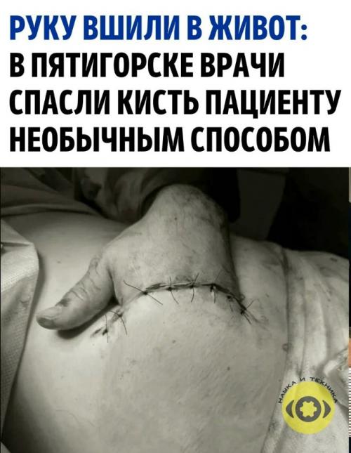 На руку 37-летнего пациента пятигорской больницы упала бетонная плита.  