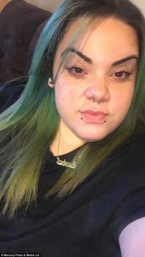 Альма торес, девушка у которой в 15 лет произошел гормональный сбой, и у неё начали расти лишние волосы на лице. 02