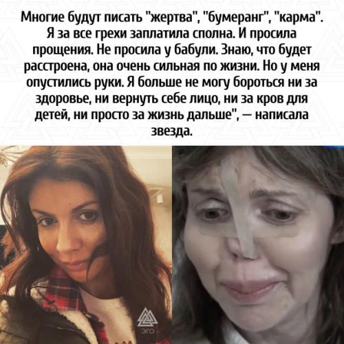 У девушки обнаружили аутоиммунный некроз. 01