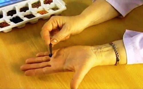 Су Джок - скорая помощь в любых ситуациях! 06 Су Джок - скорая помощь в любых ситуациях! 06