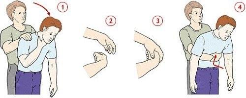 Что делать если ребенок подавился! 05