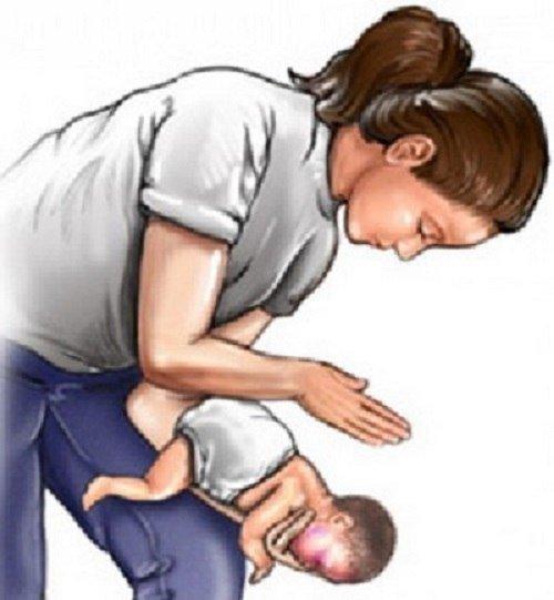 Что делать если ребенок подавился!