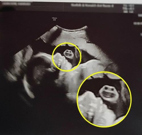 9 Лет работаю узисткой - и иногда мне страшно! 02