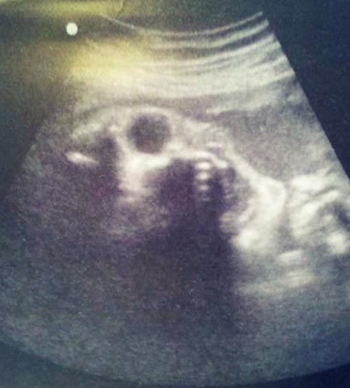 9 Лет работаю узисткой - и иногда мне страшно! 01