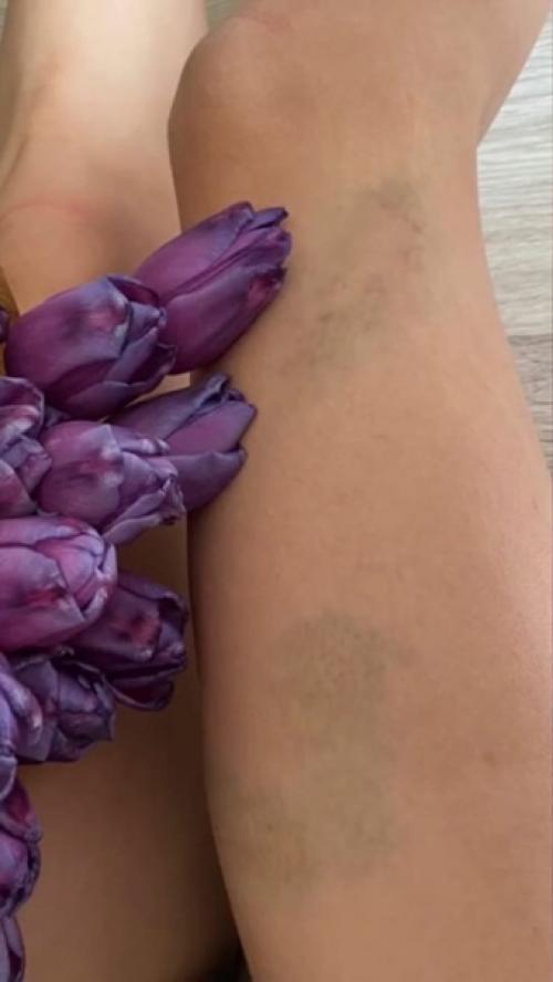 Как одним фото объяснить абъюзивное отношение к себе. 02