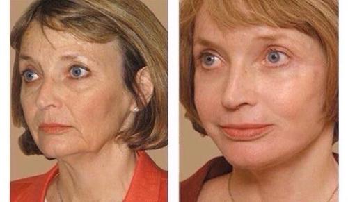 Привет, есть рекламное место на завтра.