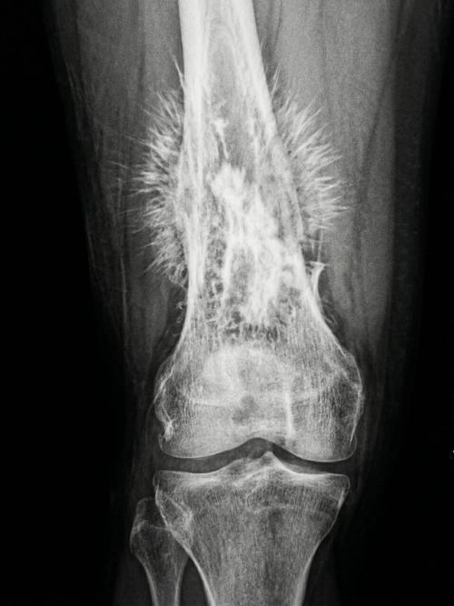 Иногда один снимок говорит о болезни страшнее любых диагнозов на бумаге. 01