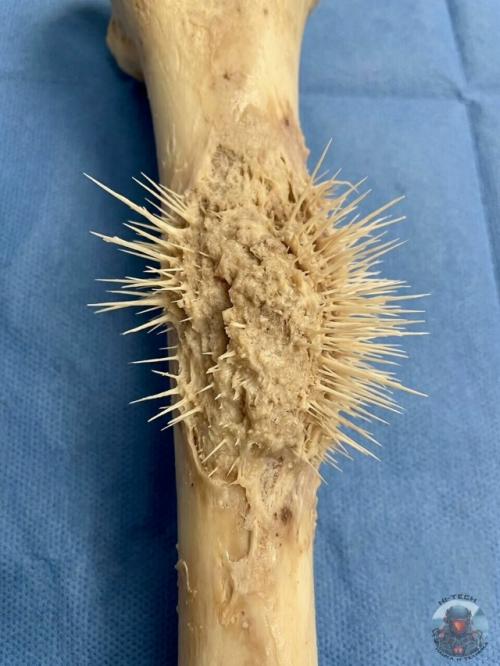 Иногда один снимок говорит о болезни страшнее любых диагнозов на бумаге. 

