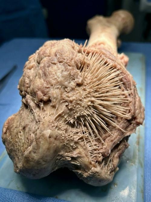 Иногда один снимок говорит о болезни страшнее любых диагнозов на бумаге. 02