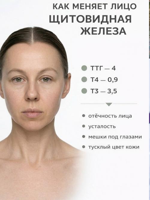 Щитовидная железа: не просто анализы - ваше истинное отражение. 01