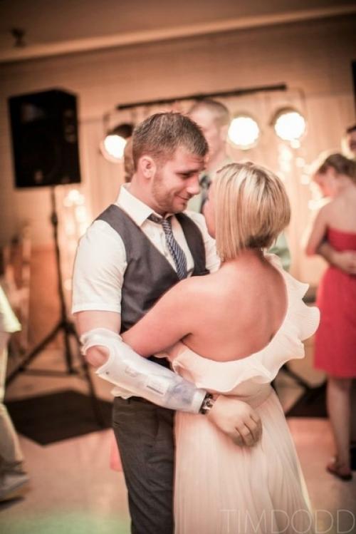 Парень конечности после службы в Афганистане потерял. 02