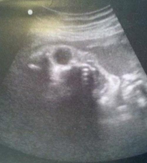 9 лет работаю узисткой в больнице. 01