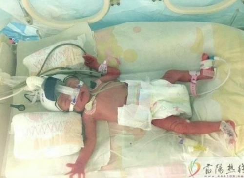 Китаянка знала, что ждёт тройню, когда забеременела в августе 2016 года. 
