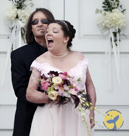 Он потерял лицо, она - руки.  