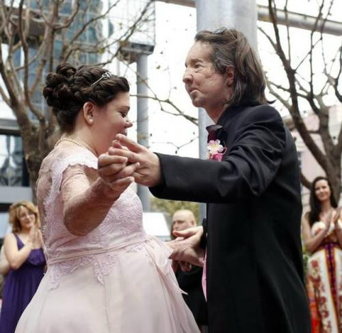 Он потерял лицо, она - руки. 01