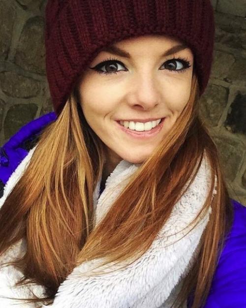 Эта девушка длительное время болела анорексией и весила всего 29 кг! 02