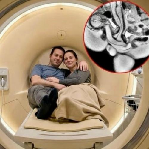 Супружеская пара приняла участие в МРТ- исследовании, чтобы показать, что происходит внутри тела во время с * kca. 

