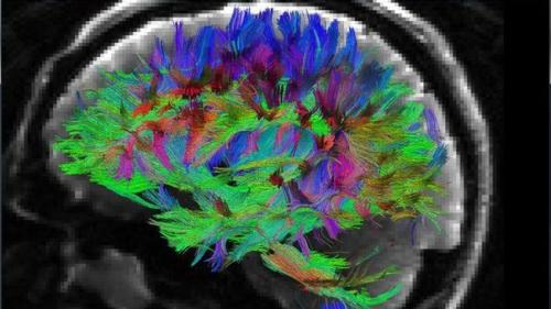 Человeчeский мозг и cоциальноe повeдениe.