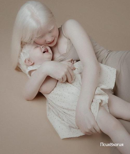 Детки - альбиносы по-своему очаровательные!