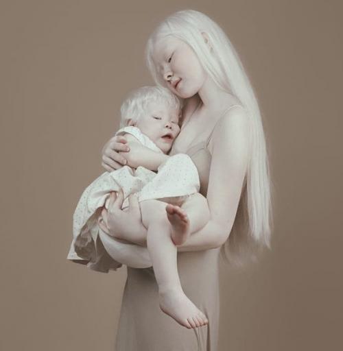 Детки - альбиносы по-своему очаровательные! 03