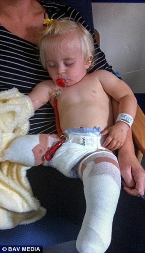 Дэйзи - Мэй Деметре родилась в Великобритании с недоразвитыми малоберцовыми костями. 01