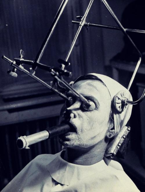 Жуткая процедура 1937 года: косметический уход, который путём боли обеспечивал молодость.

