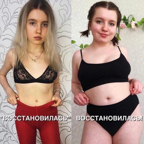Эта красотка сумела побороть анорексию. 02